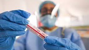Covid 19/contrôle aux frontières/ Information sur les tests PCR