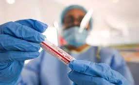 Covid 19/contrôle aux frontières/ Information sur les tests PCR